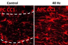 Study reveals ways in which 40Hz sensory stimulation may preserve brain’s “white matter”