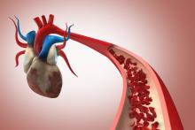 New method enables fast, accurate estimates of cardiovascular state to inform blood pressure management