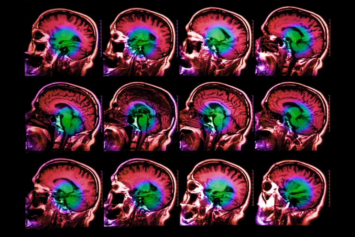 Scientists find neurons that process language on different timescales